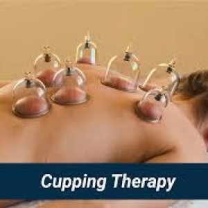 Cupping Therapy